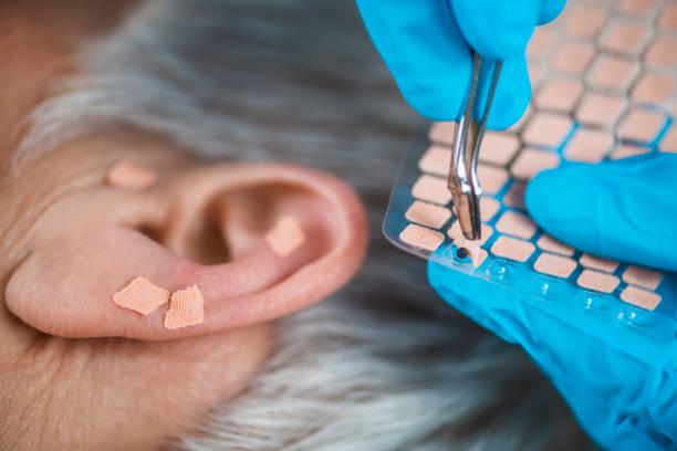Auriculoterapia para Dor de Cabeça: Alívio Natural e Eficaz